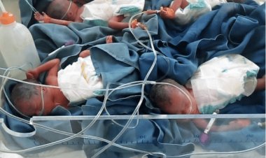 Nyabihu: Impanga enye ziherutse kuvuka hasigaye  umwe.