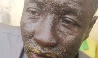 Hadutse icyorezo kitazwi kibasiye abarobyi